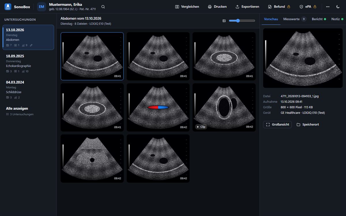 SonoBox-Viewer: Untersuchungen nach Datum, Bildergalerie mit Clips, Vorschau mit Messwerten